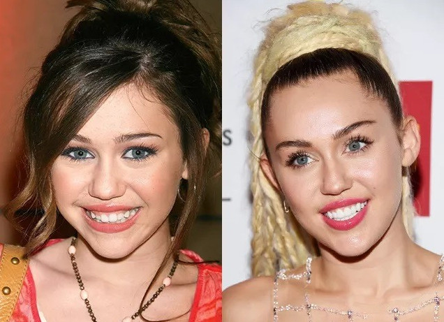 Фотографии крупно про зубы